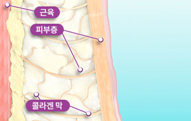 콘텐츠 이미지
