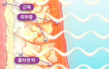 콘텐츠 이미지