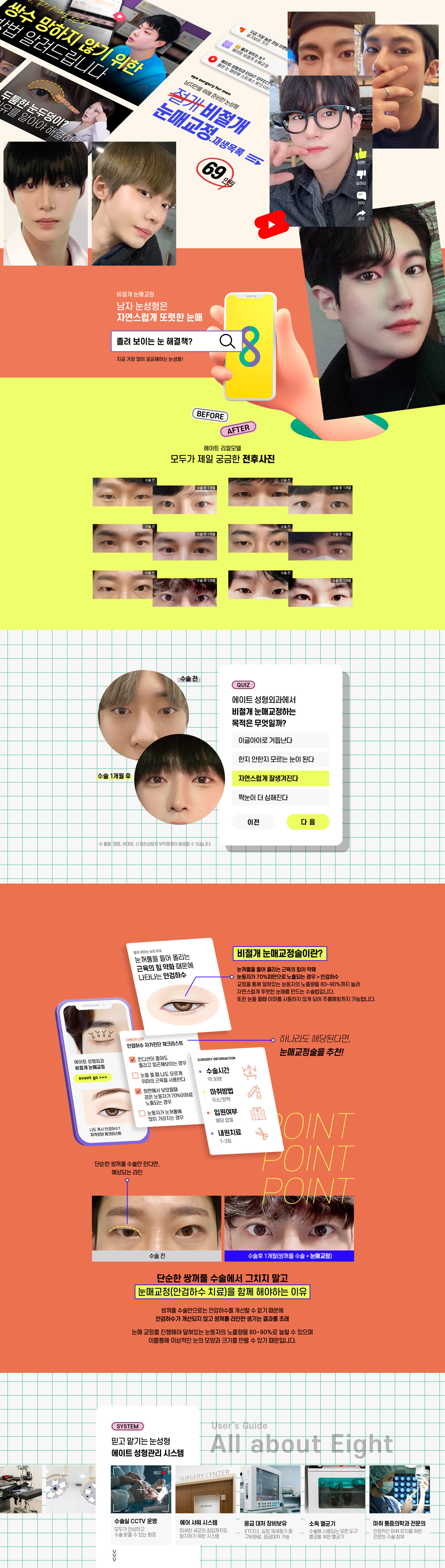 남자 비절개 눈매교정