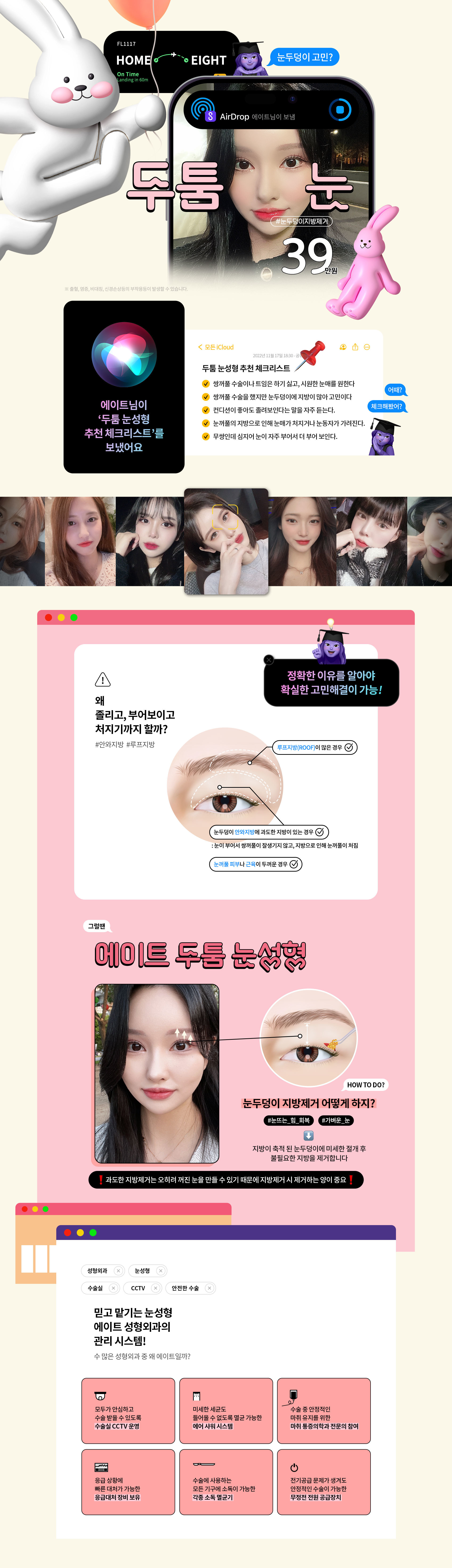 “눈두덩이지방제거이벤트이미지"