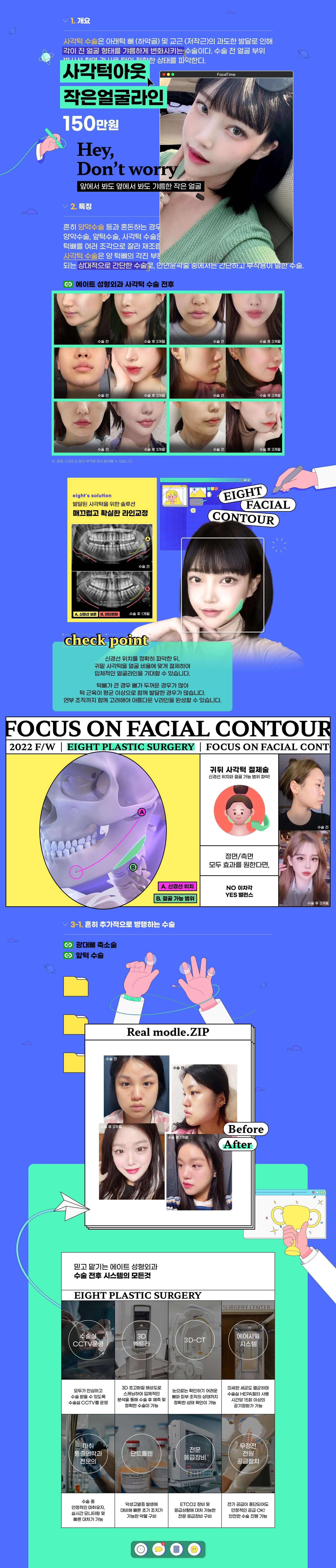 광대축소술이벤트이미지