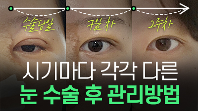 자연스러운가슴성형