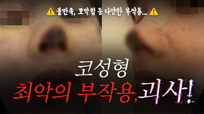 자연스러운가슴성형