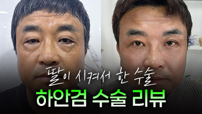 자연스러운가슴성형