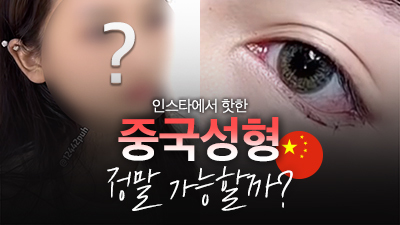 자연스러운가슴성형