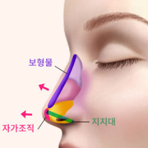 콘텐츠 이미지