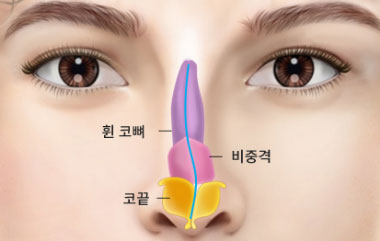 콘텐츠 이미지
