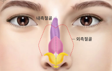 콘텐츠 이미지