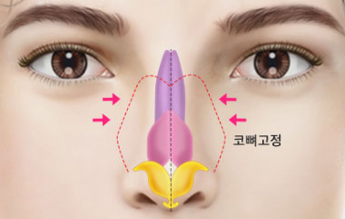 콘텐츠 이미지