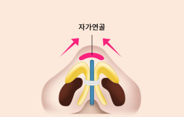 콘텐츠 이미지