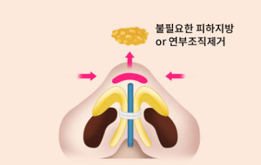 콘텐츠 이미지