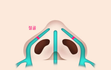 콘텐츠 이미지