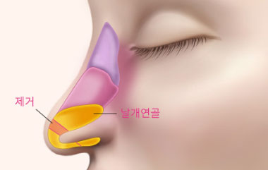 콘텐츠 이미지