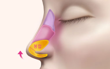 콘텐츠 이미지