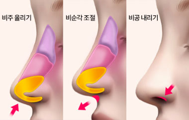 콘텐츠 이미지
