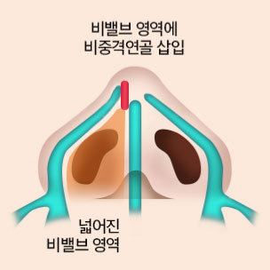 콘텐츠 이미지
