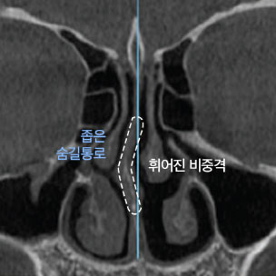 콘텐츠 이미지