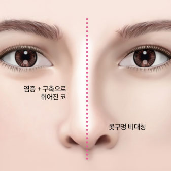 콘텐츠 이미지