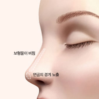 콘텐츠 이미지