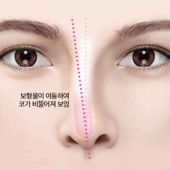 콘텐츠 이미지