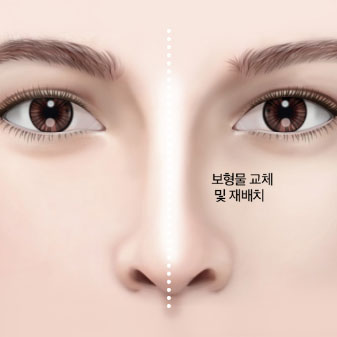 콘텐츠 이미지