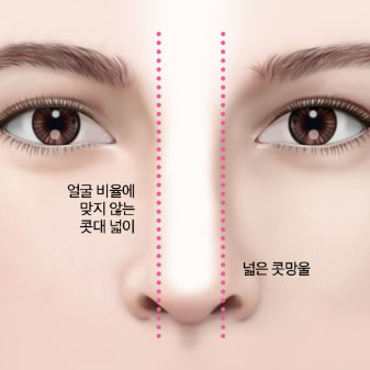 콘텐츠 이미지