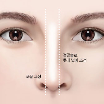 콘텐츠 이미지