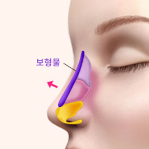콘텐츠 이미지
