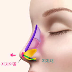 콘텐츠 이미지
