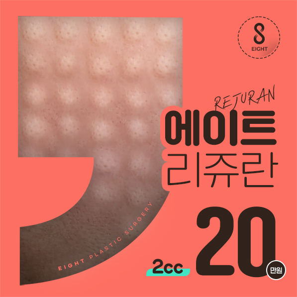 수면 리쥬란+릴리물광톡신